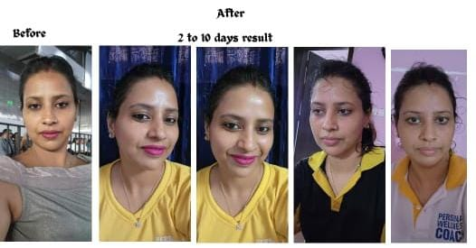 Weight Loss Transformation Result 2